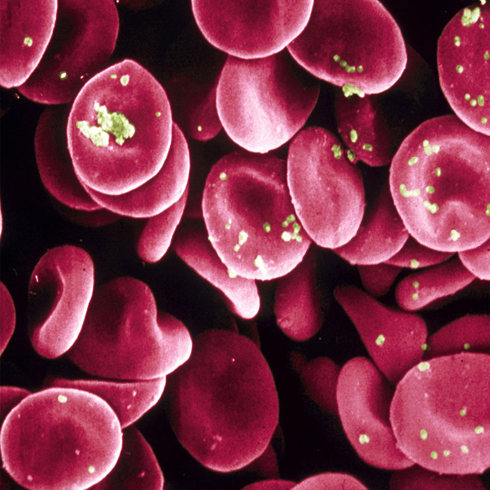 P4DP22 - Red Blood Cells.Scanning electron microscope -